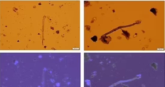 تكنولوجيا  – العثور على جزيئات بلاستيكية سامة فى المشيمة البشرية