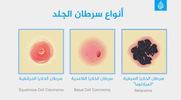 هل يؤدي واقي الشمس إلى نقص فيتامين دي؟ وهل ضوء الشمس من النافذة مفيد؟ | صحة – البوكس نيوز