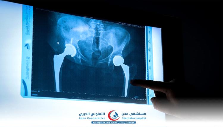 البروفيسور عبدالفتاح السعيدي يجري أولى عملياته الجراحية في مستشفى عدن التعاوني الخيري